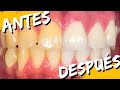 ME BLANQUEO LOS DIENTES /  Entrevista a un Odontólogo