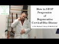 How to Stop Progression of Cervical Degenerative Disc Disease Home Self Rehab Tutorial