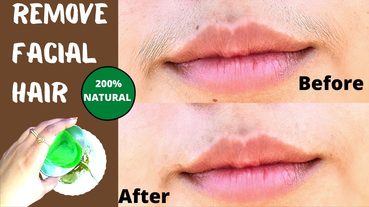 How to Remove Facial Hair Permanently, Naturally, Unwanted facial hair