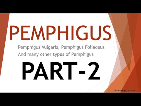 Video: Systémové Retinoidy Na Liečbu Vzrastajúcich IgA Pemphigus