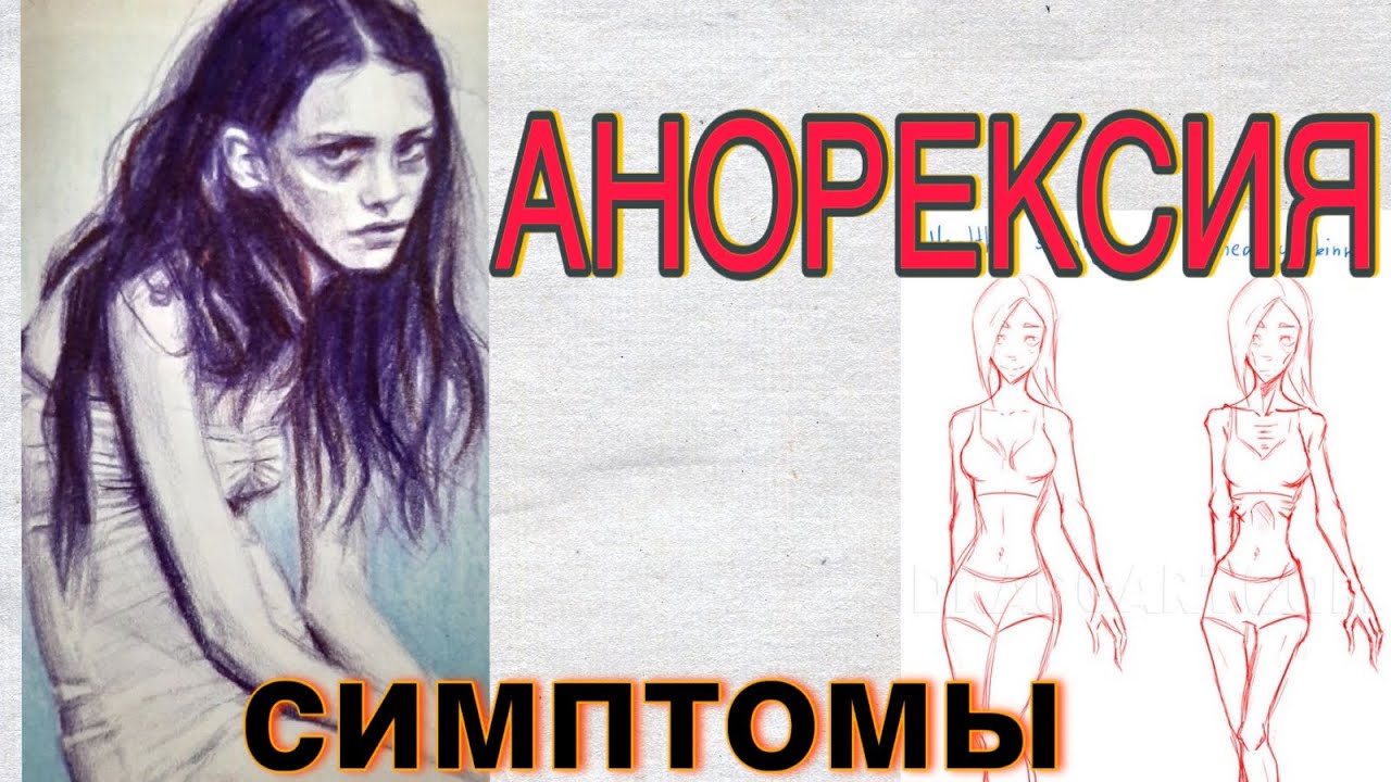 Анорексия: К чему довела диета Полину Гагарину? | Новости Шоу Бизнеса ...