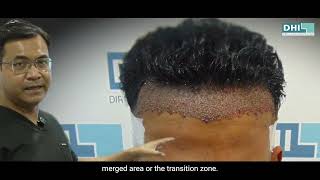 Download Lagu Een te hoge dichtheid is niet het doel, de juiste dichtheid wel. MP3