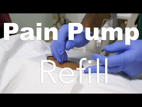 Behind The Scenes: Intrathecal Pain Pump Refill