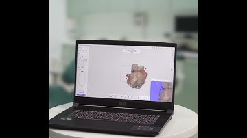 Laptop vs Console -which is better for dental intraoral scanners?