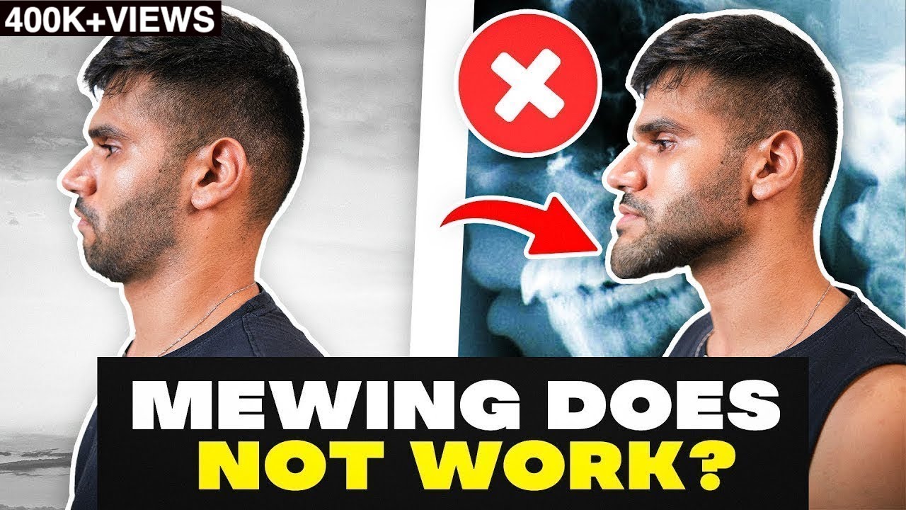 How To Get a Sharp Jawline *HONEST*, Mewing Exercises & Tricks