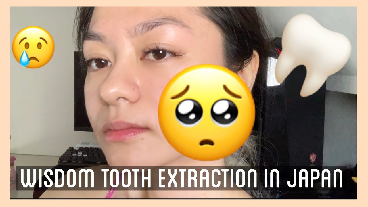 WISDOM TOOTH EXTRACTION IN JAPAN itsyuki YouTube
