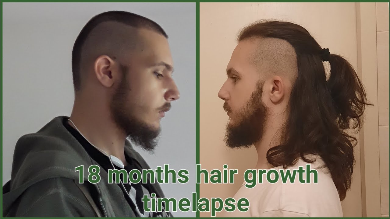 18 months hair growth timelapse men (half up back) YouTube