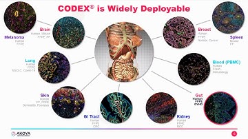 Applying a single cell GPS to discover novel spatial biomarkers in FFPE tissues