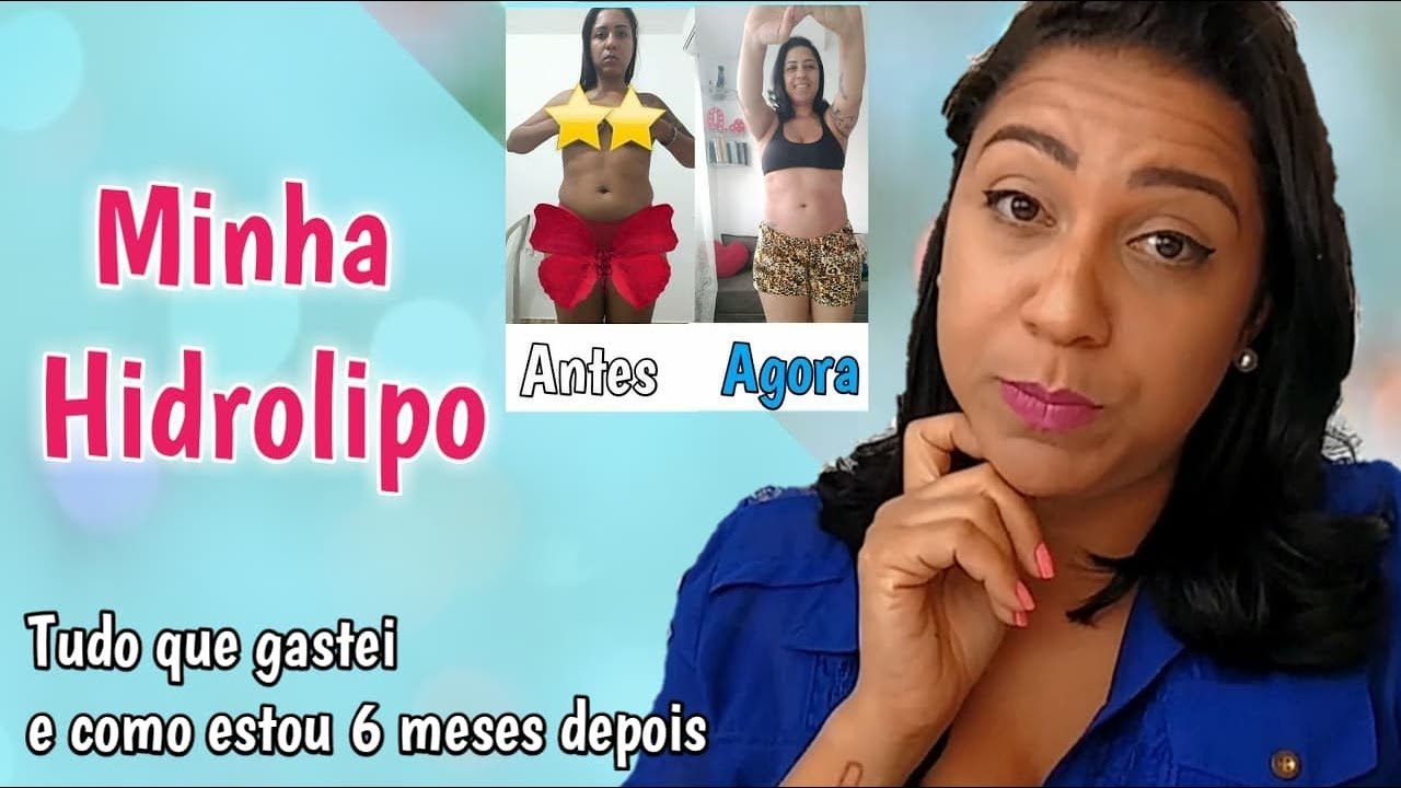 Hidrolipo Com Soro Antes E Depois - RETOEDU
