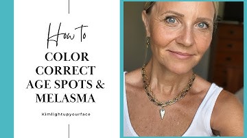 Color Correction- Age Spots & Melasma