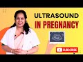 Pregnancy Ultrasound &amp; Sonography Explained 🤰 | कितने Scan ज़रूरी हैं, कब और क्यों? #pregnancycare 