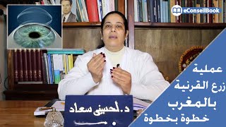 Dr Souad LAHSSINI |  عملية زرع قرنية العين في المغرب: كل ما تحتاج معرفته  | الدكتورة سعاد لحسيني