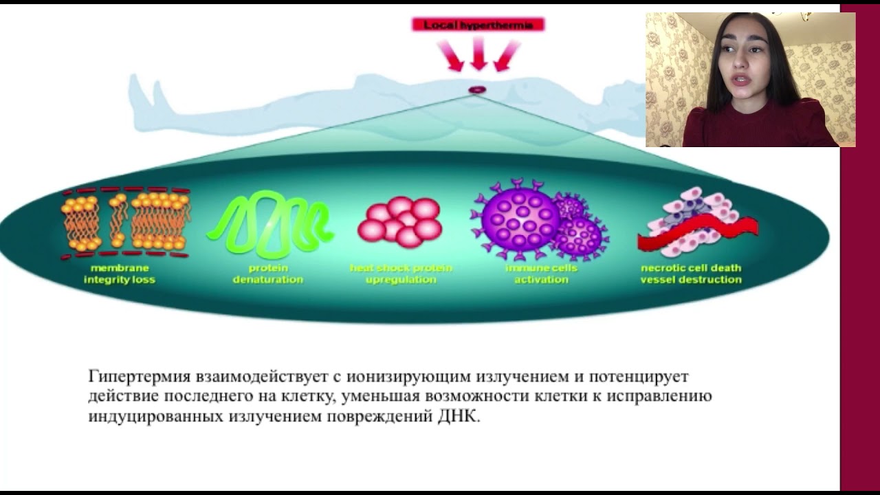 17 «Метод гипертермии при лечении онкологических заболеваний»