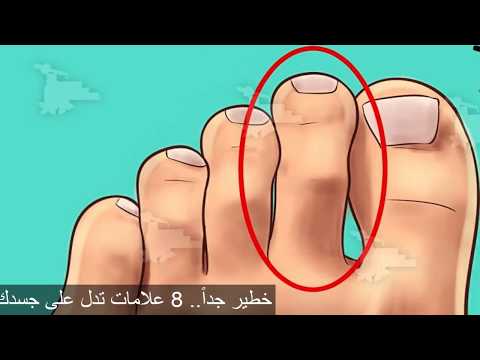 فيديو: ماذا تعني اصبع القدم للجيش؟