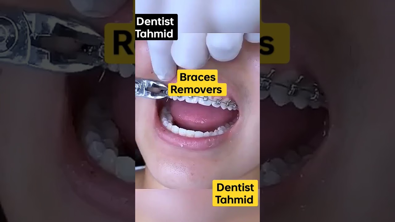 Jefferson Dental Braces Colors Dental Clinic