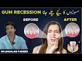      gum recession  inqalabfareed