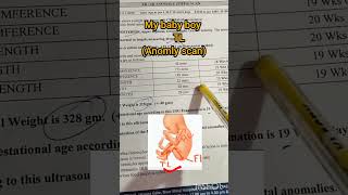 TL in Ultrasound Anomaly Scan | TL Meaning in Pregnancy Report Explained