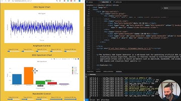 Improving Synthetic EEG Signal and Noise Generation for Biomedical Research