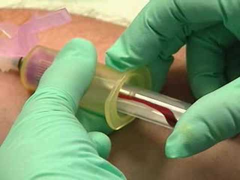 Venipuncture