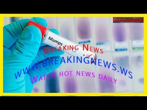 What are mumps? Signs and symptoms of the contagious virus - YouTube