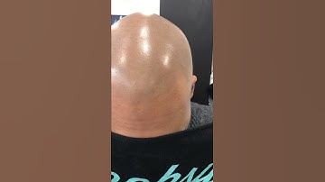 UP CLOSE LOOK at ScalpMicropigmentation