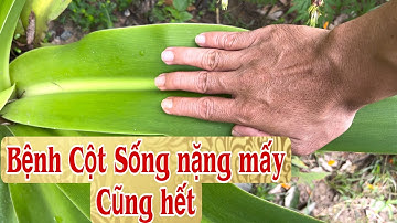 Bệnh Cột Sống nặng mấy cũng hết, trị xẹp đốt sống, xẹp đĩa đệm, thoái hoá Cột Sống. PHAN HẢI Channel