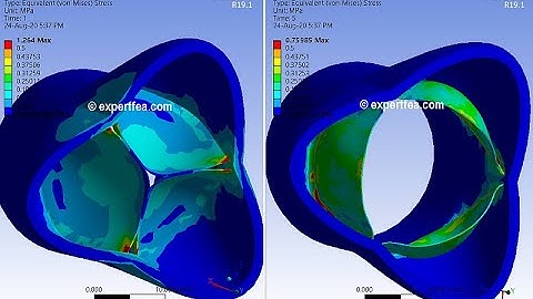 ANSYS WB Static Structural - FEA simulation of the closing and opening of an aortic valve