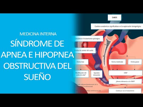 Vídeo: Diferencia Entre Apnea E Hipopnea