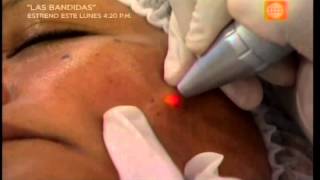 Dr. TV Perú (02-09-2015) - B1 - Tema Del Día: Verrugas, Lunares y Acrocordones