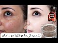 Coffee And Cornstarch Removes 20 Years Of Darkness Whitens Face Body And Sensitive Areas I 
