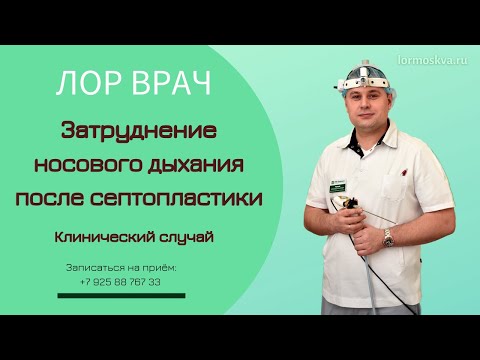 Затруднение носового дыхания после септопластики 👃👨‍⚕️ Разбор клинического случая