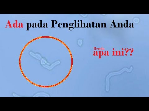 Video: Apa Jenis Penglihatan Yang Boleh Anda Pandu