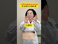 7 Skin Diseases That Make You Ugly One Video Teaches You How to Deal with them#Blackhead#A