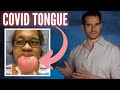 The Mystery of COVID TONGUE Explained