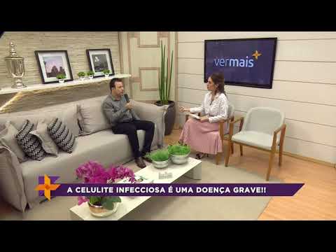 Celulite infecciosa: conheça as causas, os sintomas e o tratamento dessa infecção fatal!