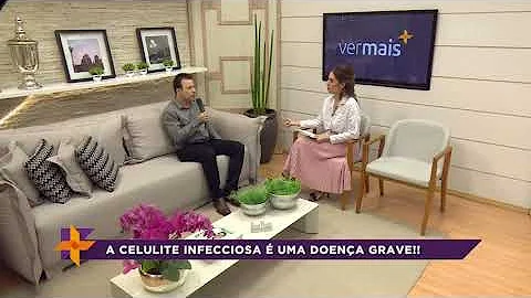 Como se contrai a bactéria celulite?