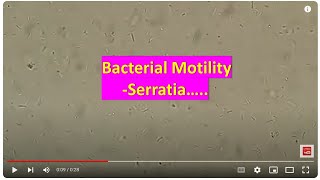 Bacterial Motility | Serratia fonticola