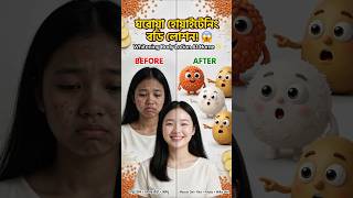মসুর ডাল দিয়ে ঘরোয়া হোয়াইটেনিং বডি লোশন! Whitening Body Lotion At Home #WhiteningBodyLotion