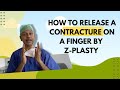 Contracture release of finger by zplasty