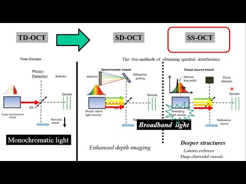 Vidéo: Différence Entre Le Domaine Spectral OCT Et Le Domaine Temporel