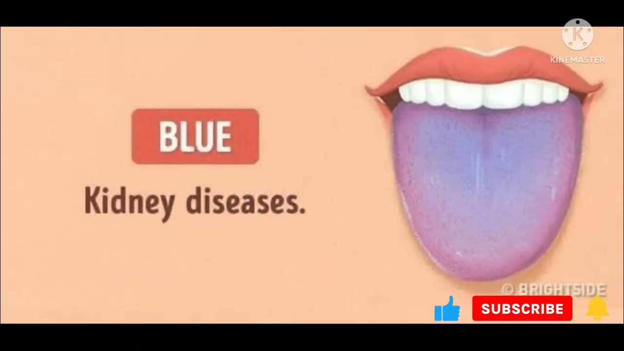 Синий рот. Синий рот. Из за чего синий язык. Из за чего синий язык. Заболевания по цвету языка.