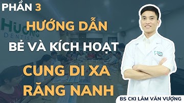 Hướng Dẫn Bẻ Và Kích Hoạt Cung Di Xa Răng Nanh P3