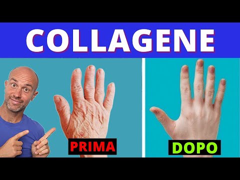 Video: Il collagene aiuta con la pelle flaccida?