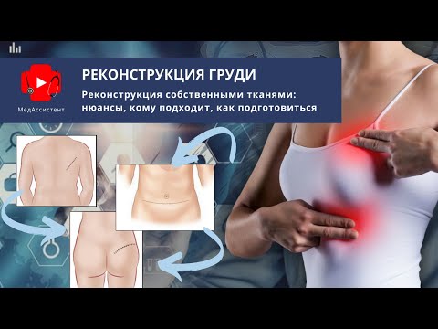 Реконструкция груди собственными тканями: кому подходит, как подготовиться