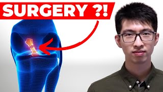 ACL Injury: Does it Require Reconstruction (Surgery Vs No Surgery)