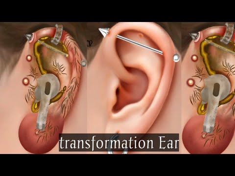 Ear Deep Clean &Piercing Transformation 🔥 Most Satisfyng Ear Wax ...