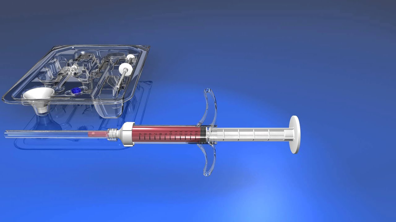 OsteoPrecision™ Graft Delivery Device from Nordson Medical YouTube