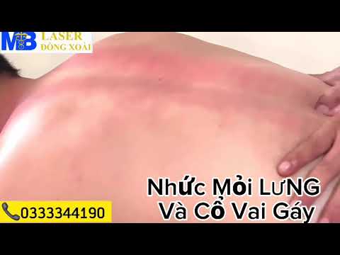 Nhức Mỏi Lưng Và Cổ Vai Gáy - MB ĐỒNG XOÀI
