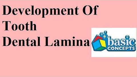 Dental lamina : Devp of tooth Part 1a