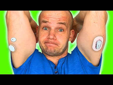 FreeStyle Libre vs Dexcom | Which is ACTUALLY Better